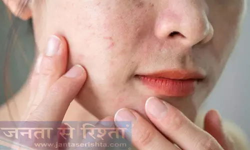 बरसात के मौसम में अपनी त्वचा को खतरनाक बैक्टीरिया से कैसे बचाएं?