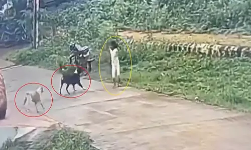Karnataka : बिस्कुट लेने गई लड़की पर आवारा कुत्तों का हमला Karnataka : बिस्कुट लेने गई लड़की पर आवारा कुत्तों का हमला