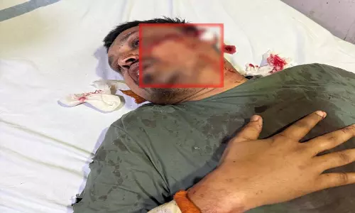 रायपुर केंद्रीय जेल में दोबारा चाकूबाजी, गैंगवार का खुलासा रायपुर केंद्रीय जेल में दोबारा चाकूबाजी, गैंगवार का खुलासा