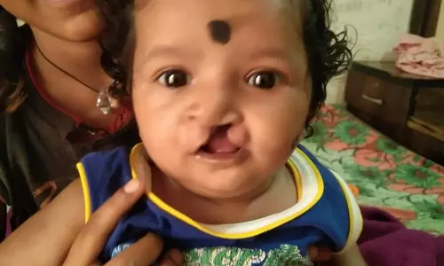 चिरायु योजना ने लौटाई मासूमों की मुस्कान