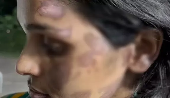 चेहरे-हाथ को जलाया, पत्नी को कई दिन तक बंधक बनाकर रखा था, पति गिरफ्तार चेहरे-हाथ को जलाया, पत्नी को कई दिन तक बंधक बनाकर रखा था, पति गिरफ्तार