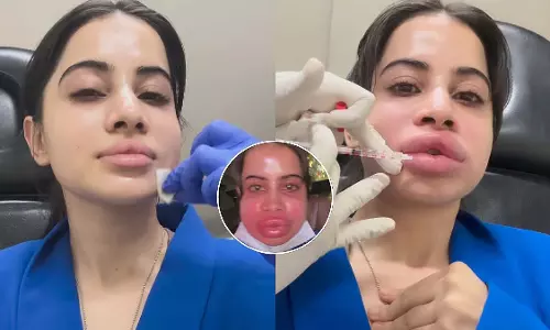 Urfi Javed : चौंकाने वाला खुलासा, लिप फिलर्स से तौबा का किया ऐलान Urfi Javed : चौंकाने वाला खुलासा, लिप फिलर्स से तौबा का किया ऐलान