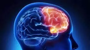 स्मृति हानि और व्यवहार में बदलाव मस्तिष्क क्षय के संकेत: विशेषज्ञ स्मृति हानि और व्यवहार में बदलाव मस्तिष्क क्षय के संकेत: विशेषज्ञ