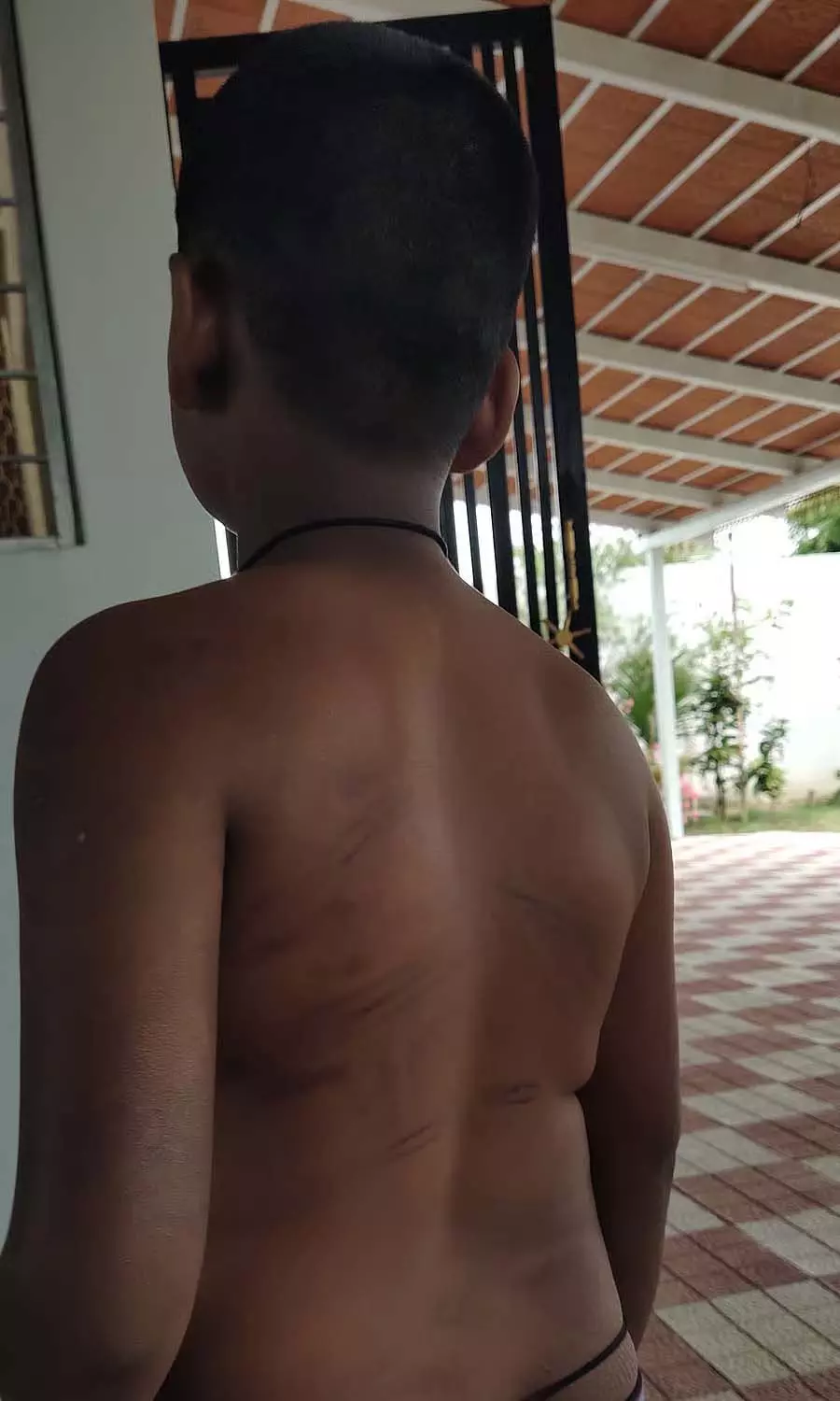 Mulbagal : वार्डन ने छात्र को वसुंदे के पास आने के लिए पीटा Mulbagal : वार्डन ने छात्र को वसुंदे के पास आने के लिए पीटा
