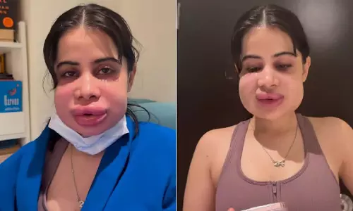 Urfi Javed : का नया वीडियो वायरल, नेटिज़ेंस ने कहा ‘हिम्मती Urfi Javed : का नया वीडियो वायरल, नेटिज़ेंस ने कहा ‘हिम्मती