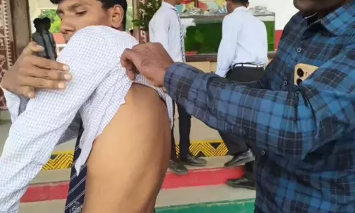 नवोदय विद्यालय में शिक्षक पर सात छात्रों की बेरहमी से पिटाई का आरोप, परिजनों में आक्रोश