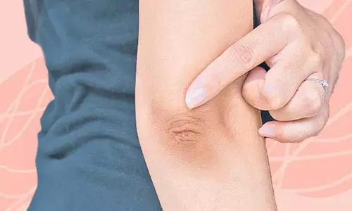 कालेपन से छुटकारा पाने के लिए अपनाएं ये टिप्स कालेपन से छुटकारा पाने के लिए अपनाएं ये टिप्स
