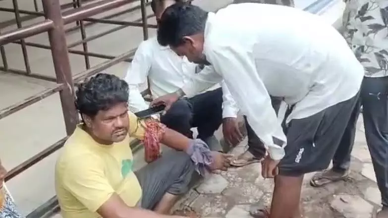 सांप के काटने के बाद इमरजेंसी वार्ड के बाहर परिवार द्वारा तांत्रिक अनुष्ठान करने पर व्यक्ति बाल-बाल बचा सांप के काटने के बाद इमरजेंसी वार्ड के बाहर परिवार द्वारा तांत्रिक अनुष्ठान करने पर व्यक्ति बाल-बाल बचा