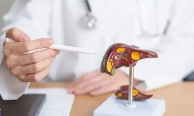 Assam: तिनसुकिया में पीलिया के प्रकोप से चिंता Assam: तिनसुकिया में पीलिया के प्रकोप से चिंता