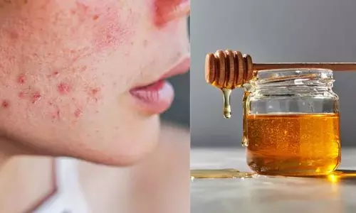 रसोई से निकले 5 चमत्कारी उपाय, पाएं बेदाग और निखरी त्वचा रसोई से निकले 5 चमत्कारी उपाय, पाएं बेदाग और निखरी त्वचा