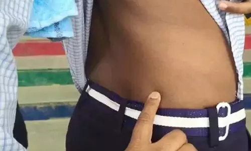 टीचर ने रॉड से पीटा, 7 स्टूडेंट्स घायल