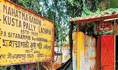 कुष्ठ रोग के कारण उनकी एक उंगली चली गई और उन्हें राशन और आधार कार्ड पाने में परेशानी हो रही कुष्ठ रोग के कारण उनकी एक उंगली चली गई और उन्हें राशन और आधार कार्ड पाने में परेशानी हो रही