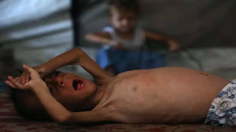 Gaza में भुखमरी का खतरा; इजरायल ने अंतरराष्ट्रीय खाद्य वितरण को मंजूरी दी Gaza में भुखमरी का खतरा; इजरायल ने अंतरराष्ट्रीय खाद्य वितरण को मंजूरी दी