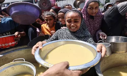 Gaza के डॉक्टर भूखे बच्चों को बचाने की कोशिश में भूख से मर रहे