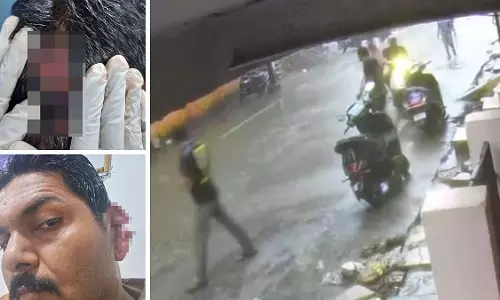 Gwalior: कांस्टेबल को बेरहमी से पीटा, कान फाड़ा, 3 हिरासत में Gwalior: कांस्टेबल को बेरहमी से पीटा, कान फाड़ा, 3 हिरासत में