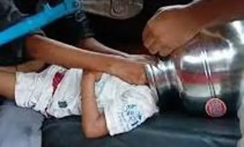 Odisha: खेलते समय बच्चे का सिर स्टील के बर्तन में फंस गया