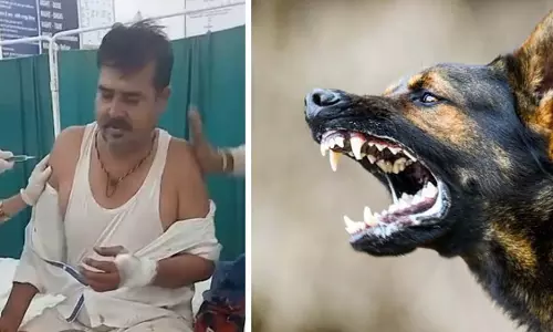 MP : कुक्षी में आवारा कुत्तों का आतंक, 30 से ज्यादा लोग घायल