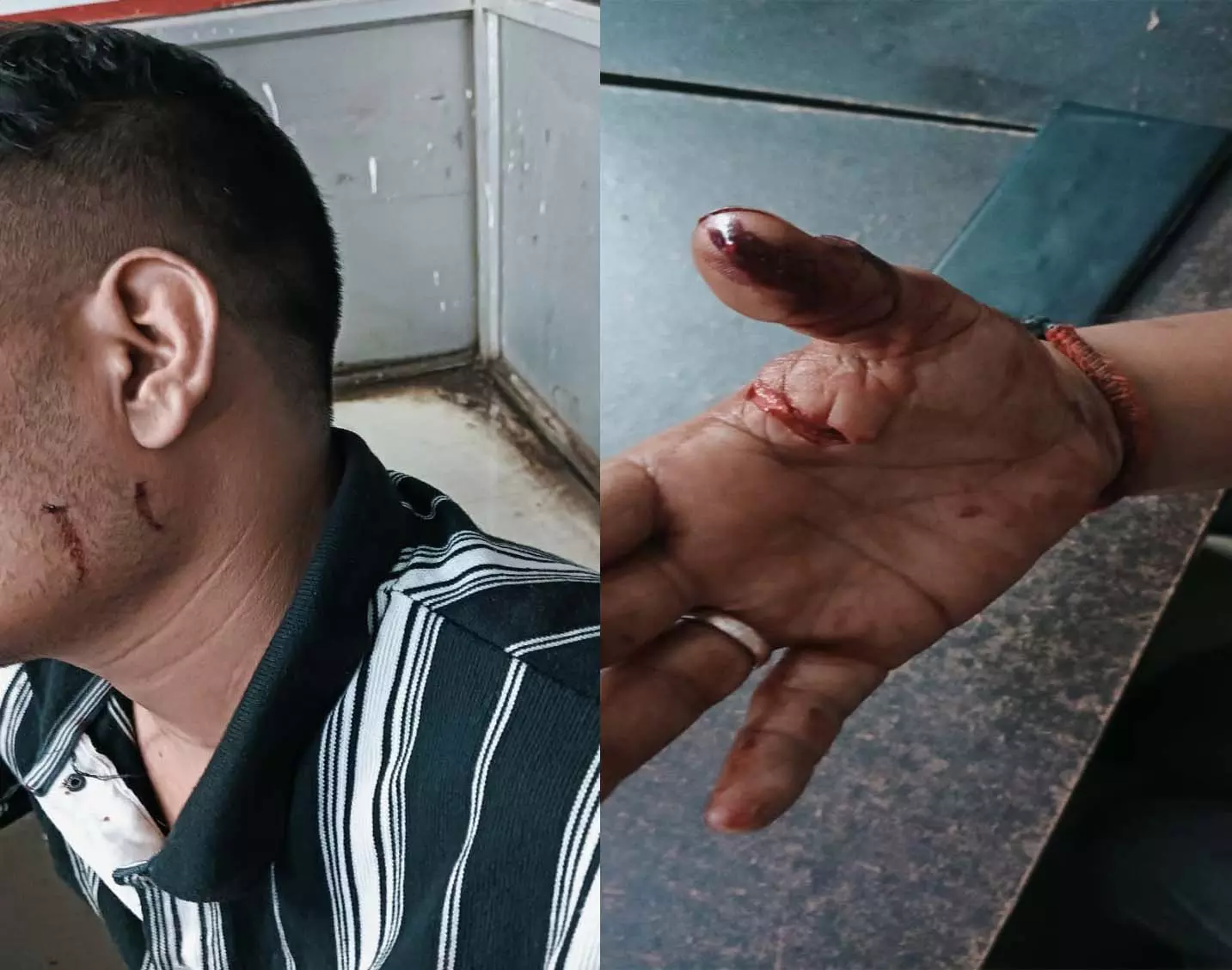 पुरानी बस्ती में नशे को लेकर हुआ विवाद, मोहसिन पाशा पर चाकू से हमला पुरानी बस्ती में नशे को लेकर हुआ विवाद, मोहसिन पाशा पर चाकू से हमला