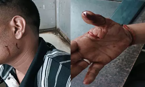 पुरानी बस्ती में नशे को लेकर हुआ विवाद, मोहसिन पाशा पर चाकू से हमला पुरानी बस्ती में नशे को लेकर हुआ विवाद, मोहसिन पाशा पर चाकू से हमला