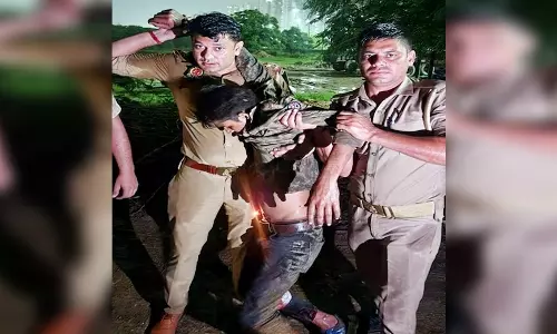 बड़ा एक्शन: पत्रकार पर हमला करना पड़ा भारी, बदमाश का हुआ ये हाल बड़ा एक्शन: पत्रकार पर हमला करना पड़ा भारी, बदमाश का हुआ ये हाल