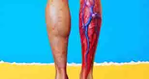 Health : स्वामी रामदेव की इस थेरेपी से नसों में झुनझुनी, अकड़न और जलन दूर करें Health : स्वामी रामदेव की इस थेरेपी से नसों में झुनझुनी, अकड़न और जलन दूर करें