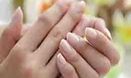 Skin care: हाथों का कालापन दूर करने का आसान तरीका, शीशे की तरह चमकेंगे