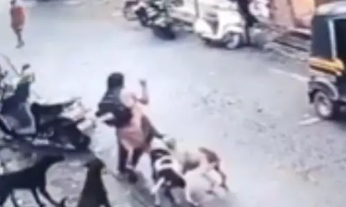 Ulhasnagar : सड़क पर कुत्तों का जानलेवा हमला, बच्ची की जान बची Ulhasnagar : सड़क पर कुत्तों का जानलेवा हमला, बच्ची की जान बची