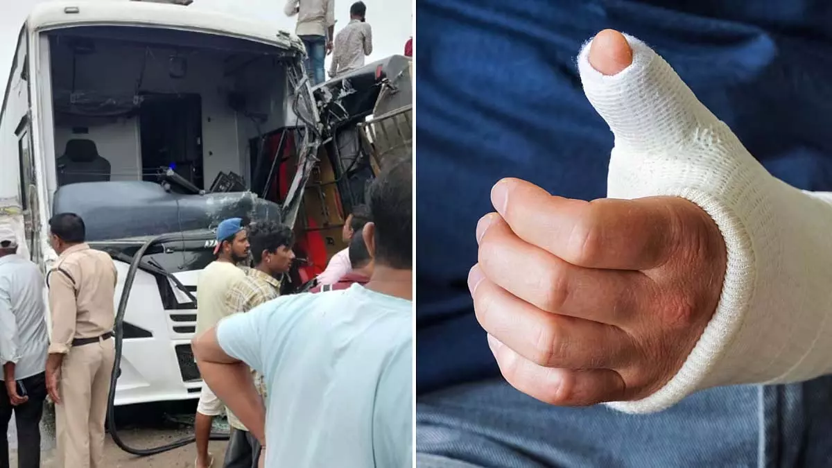 भोपाल-इंदौर हाईवे पर दो बसों की टक्कर; एक बस में फ्रैक्चर, कई घायल भोपाल-इंदौर हाईवे पर दो बसों की टक्कर; एक बस में फ्रैक्चर, कई घायल