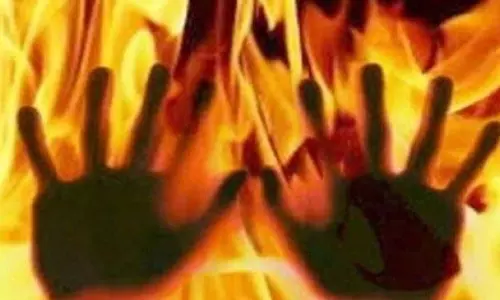 बलंगा अग्निकांड में घायल व्यक्ति की मौत पर शोक संवेदनाएं बलंगा अग्निकांड में घायल व्यक्ति की मौत पर शोक संवेदनाएं