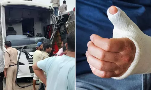 भोपाल-इंदौर हाईवे पर दो बसों की टक्कर; एक बस में फ्रैक्चर, कई घायल भोपाल-इंदौर हाईवे पर दो बसों की टक्कर; एक बस में फ्रैक्चर, कई घायल