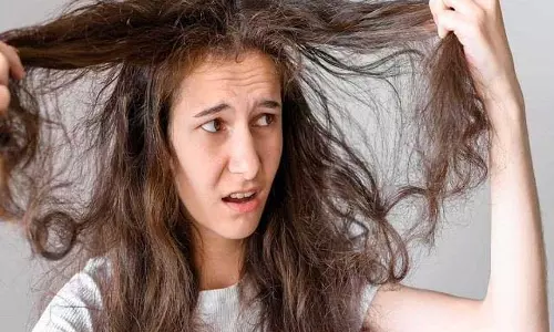 Hair Care: बारिश के मौसम में चिपचिपे बालों से बदबू आती है, तो आज़माएँ आसान तरीके