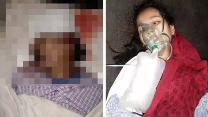 जबलपुर में नशे में धुत बाइक सवारों ने पिता-पुत्री को टक्कर मारी; व्यक्ति की मौत, CHO बेटी गंभीर जबलपुर में नशे में धुत बाइक सवारों ने पिता-पुत्री को टक्कर मारी; व्यक्ति की मौत, CHO बेटी गंभीर