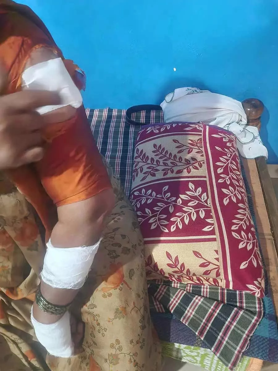 कुंदुर और होन्नाली में कुत्तों के काटने की घटनाएं बढ़ीं, ग्रामीण चिंतित कुंदुर और होन्नाली में कुत्तों के काटने की घटनाएं बढ़ीं, ग्रामीण चिंतित