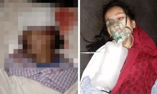जबलपुर में नशे में धुत बाइक सवारों ने पिता-पुत्री को टक्कर मारी; व्यक्ति की मौत, CHO बेटी गंभीर