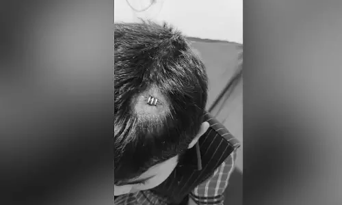 तेलंगाना में शिक्षक की लापरवाही से बच्चे को सिर में लगी चोट तेलंगाना में शिक्षक की लापरवाही से बच्चे को सिर में लगी चोट