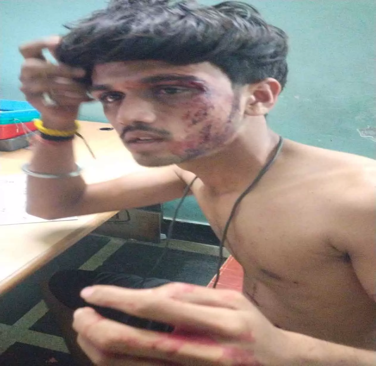 एयरपोर्ट रोड पर गौ सेवक पर तस्करों ने किया जानलेवा हमला, अस्पताल में भर्ती एयरपोर्ट रोड पर गौ सेवक पर तस्करों ने किया जानलेवा हमला, अस्पताल में भर्ती