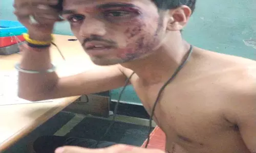 एयरपोर्ट रोड पर गौ सेवक पर तस्करों ने किया जानलेवा हमला, अस्पताल में भर्ती