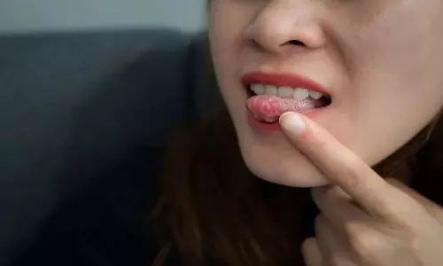 क्या आपके मुंह में अक्सर छाले होते हैं? जानें कारण और उपाय