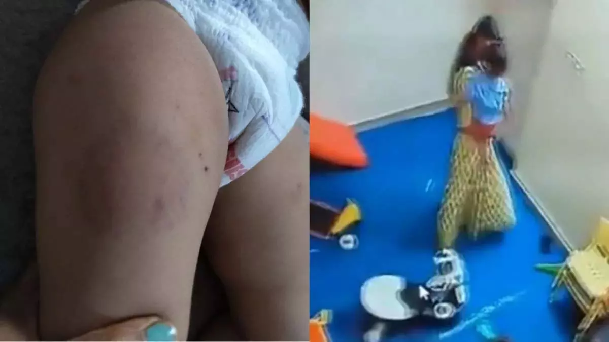 नोएडा डेकेयर में बच्चे पर हमला, आरोपी अटेंडेंट नाबालिग और बिना ट्रेनिंग नोएडा डेकेयर में बच्चे पर हमला, आरोपी अटेंडेंट नाबालिग और बिना ट्रेनिंग