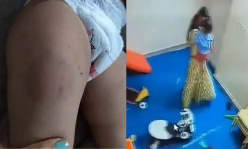नोएडा डेकेयर में बच्चे पर हमला, आरोपी अटेंडेंट नाबालिग और बिना ट्रेनिंग नोएडा डेकेयर में बच्चे पर हमला, आरोपी अटेंडेंट नाबालिग और बिना ट्रेनिंग