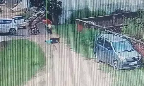 UP : अमरोहा में आवारा कुत्तों ने नाबालिग पर हमला किया UP : अमरोहा में आवारा कुत्तों ने नाबालिग पर हमला किया