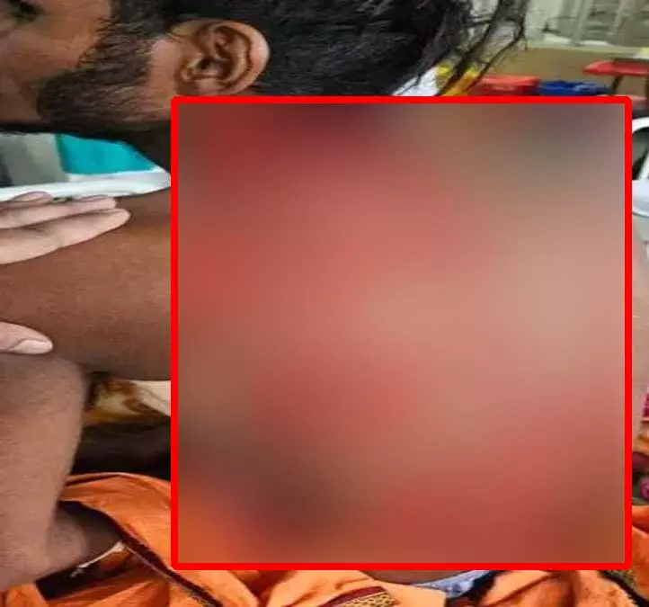 CG: चाकू के 17 वार के बाद सिम्स के डॉक्टरों ने दी नई जिंदगी CG: चाकू के 17 वार के बाद सिम्स के डॉक्टरों ने दी नई जिंदगी