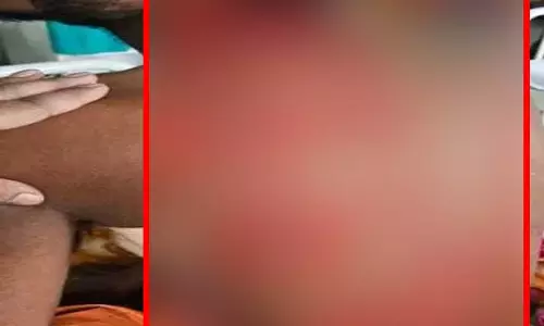 CG: चाकू के 17 वार के बाद सिम्स के डॉक्टरों ने दी नई जिंदगी