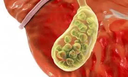 Health: पेट के इन हिस्सों में दर्द पित्ताशय की पथरी का संकेत देता है Health: पेट के इन हिस्सों में दर्द पित्ताशय की पथरी का संकेत देता है