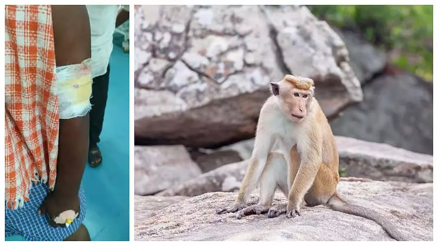 Karnataka : बंदरों के हमले में कई लोग गंभीर रूप से घायल Karnataka : बंदरों के हमले में कई लोग गंभीर रूप से घायल