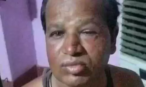 तीन युवक गिरफ्तार, पेट्रोल पंप सुपरवाइजर पर हमला करने का आरोप