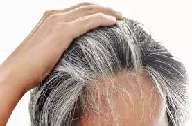 Hair Care: सफेद बालों को प्राकृतिक रूप से काला करें Hair Care: सफेद बालों को प्राकृतिक रूप से काला करें