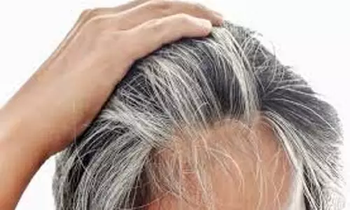 Hair Care: सफेद बालों को प्राकृतिक रूप से काला करें Hair Care: सफेद बालों को प्राकृतिक रूप से काला करें