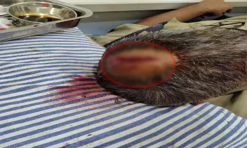 ट्रैफिक ASI पर जानलेवा हमला, नशे में धुत ट्रक ड्राइवर गिरफ्तार, पहली तस्वीर आई सामने