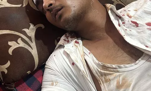 डुमरतराई सब्जी मंडी में प्राइवेट गार्ड्स की गुंडई, युवक को जबरन पीटा डुमरतराई सब्जी मंडी में प्राइवेट गार्ड्स की गुंडई, युवक को जबरन पीटा